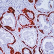 GTX23119 - basic Cytokeratin