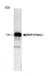 GTX23641 - BRIP1 / FANCJ