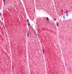 GTX24125 - TRIM63 / MURF1 / RNF28