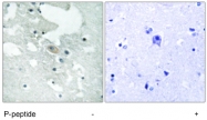 GTX24474 - B-cell linker protein / BLNK