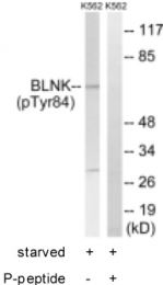 GTX24474 - B-cell linker protein / BLNK