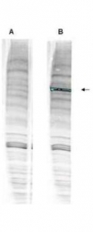 GTX24731 - ATPase WRNIP1