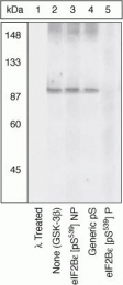 GTX24775 - EIF2B5 / EIF2BE