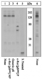 GTX24778 - Retinoblastoma-associated protein / RB1