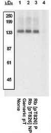 GTX24779 - Retinoblastoma-associated protein / RB1