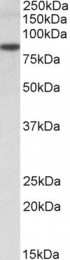 GTX24836 - TRIM36 / RNF98