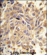 GTX25513 - Tyrosine-protein kinase RYK
