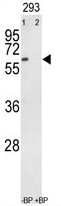 GTX25518 - Tyrosine-protein kinase RYK