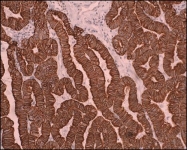 GTX26401 - pan Cytokeratin
