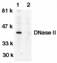 GTX28119 - Deoxyribonuclease-2-alpha