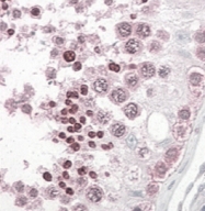 GTX28225 - InaD-like protein / INADL