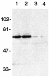 GTX28417 - TNFRSF21 / Death receptor 6 (DR6)