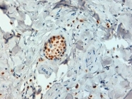 GTX29269 - Estrogen receptor alpha