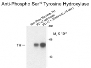 GTX31129 - Tyrosine 3-monooxygenase (TH)