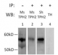 GTX31130 - Tryptophan 5-hydroxylase 2 (TPH2)