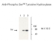 GTX31131 - Tryptophan 5-hydroxylase 2 (TPH2)