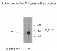 GTX31133 - Tyrosine 3-monooxygenase (TH)