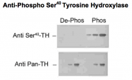 GTX31134 - Tyrosine 3-monooxygenase (TH)