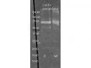 GTX40574 - Carboxypeptidase Y