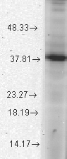 GTX42026 - ATAD1