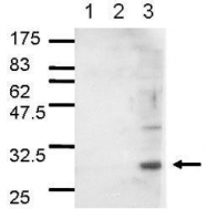 GTX42912 - 14-3-3 protein sigma / SFN