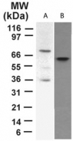 GTX46123 - Tumor protein p73 (TP73)