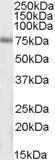 GTX47572 - IP3 3-kinase C / ITPKC
