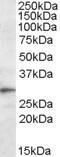GTX47596 - TREM2