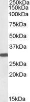 GTX47599 - engrailed-2 / EN2
