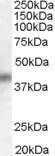 GTX47608 - DUSP1 / MKP1