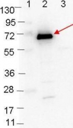 GTX48806 - Borrelia burgdorferi OspC
