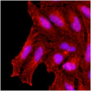 GTX50003 - TNF-beta / Lymphotoxin-alpha