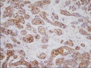 GTX50076 - Tumor protein D53 (TPD52L1)