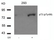 GTX50132 - Tumor protein p73 (TP73)