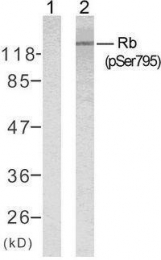 GTX50191 - Retinoblastoma-associated protein / RB1