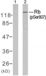 GTX50192 - Retinoblastoma-associated protein / RB1