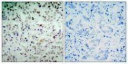 GTX50193 - Retinoblastoma-associated protein / RB1