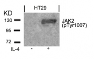 GTX50208 - Tyrosine-protein kinase JAK2