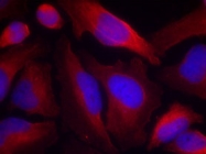 GTX50337 - Tyrosine 3-monooxygenase (TH)