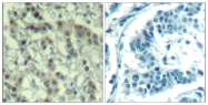 GTX50345 - Aurora kinase A