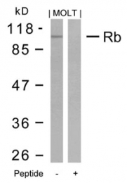 GTX50458 - Retinoblastoma-associated protein / RB1