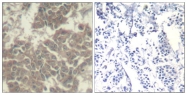 GTX50657 - Tyrosine-protein kinase JAK2
