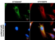 GTX628487 - Isocitrate dehydrogenase / IDH2