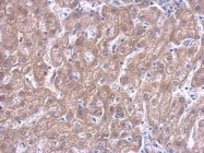 GTX628487 - Isocitrate dehydrogenase / IDH2