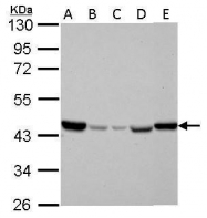 GTX628487 - Isocitrate dehydrogenase / IDH2