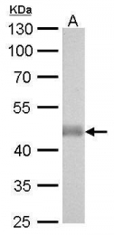 GTX628487 - Isocitrate dehydrogenase / IDH2