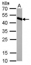 GTX628487 - Isocitrate dehydrogenase / IDH2