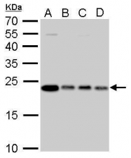 GTX628889 - Glyoxalase I / GLO1