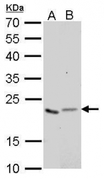 GTX628890 - Glyoxalase I / GLO1
