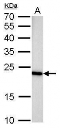 GTX628890 - Glyoxalase I / GLO1